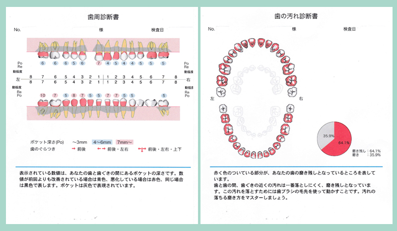 予防治療 千葉歯科クリニック 千駄木駅2番出口から徒歩3分の歯科 歯医者